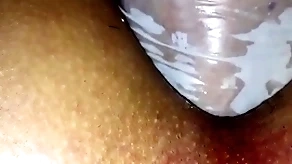 Fisting (9 chủ)