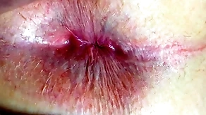 Nuisance together with anus closeup