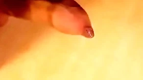 Phimosis horseshit estimable cumshot